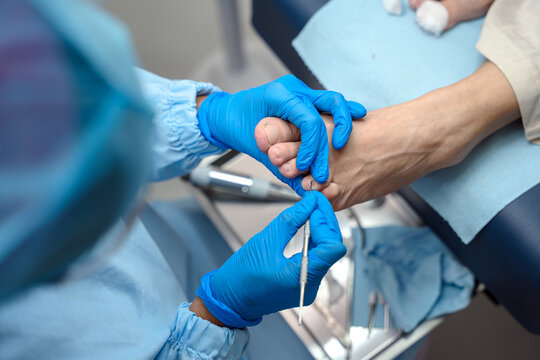Medical Foot Procedure with Podiatry Tools