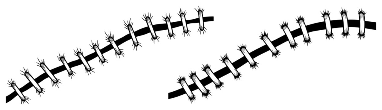 Surgical stitches and sutures on curved wounds in bold black and white line art style