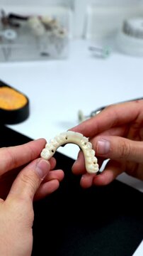 Dental Prosthetic Examination. Detailed View Of Denture Framework And Polishing Procedures Conducted