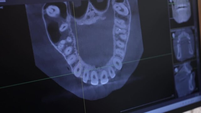 Extensive Assessment Of Dental Root Architecture Alongside Adjacent Bony Frameworks For Surgical Planning
