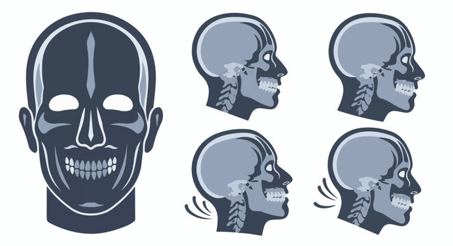 Stylized human skull front view and side profiles showing jaw movement