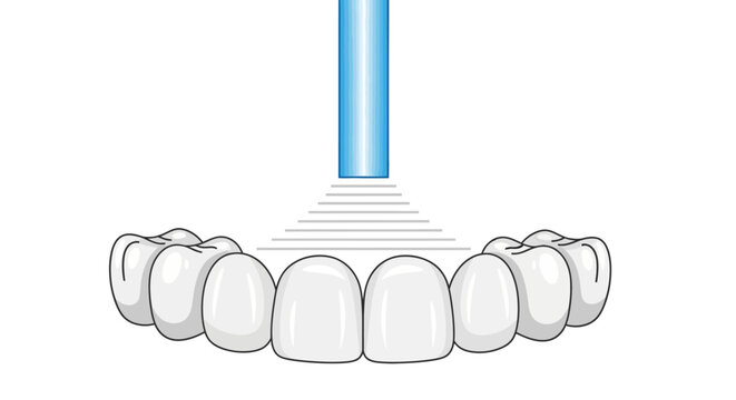 Minimal Dental Scanning Technology Illustration with Blue Laser Teeth Detection