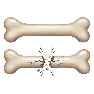 Two beige dog bones, one intact and one broken with cracks and fragments broken bone cracked bone