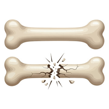 Two beige dog bones, one intact and one cracked in half cracked bone broken bone