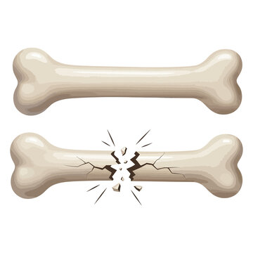 Two beige dog bones, one intact and one cracked in half cracked bone broken bone