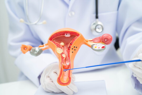 Doctor holding human uterus model for vaginal and cervix pap smear check up in the obstetrics and gynecology.
