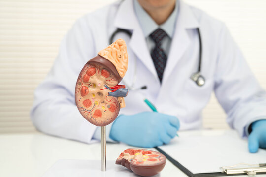 Chronic kidney disease, doctor with model for treatment urinary system, urology, Estimated glomerular filtration rate eGFR.