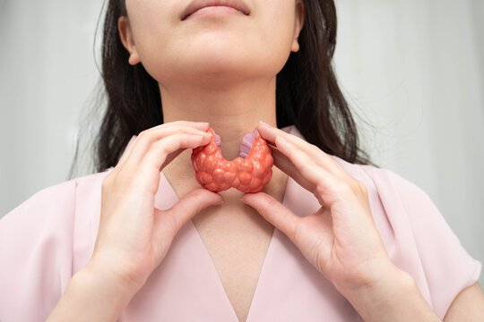 Hyperthyroidism, Overactive Thyroid, Thyroid Lymphoma, Asian woman with thyroid gland human anatomy model.