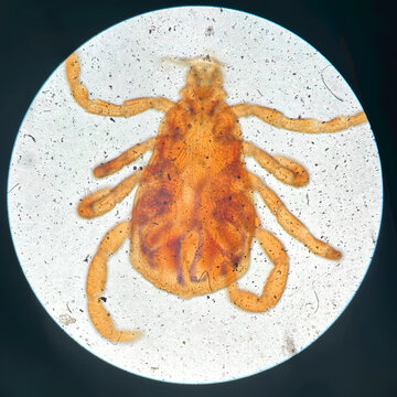 Hard Tick