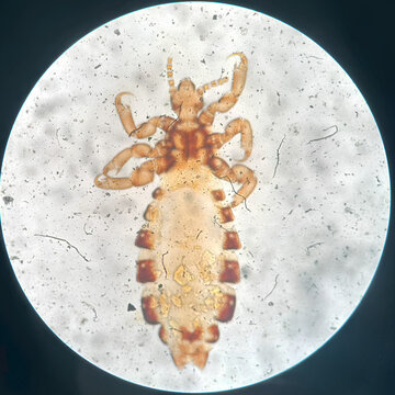 Louse