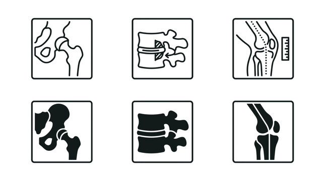 Orthopedic surgery and medical joint replacement icons set for skeletal anatomy with x ray, orthopedic