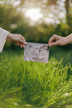 Couple holding ultrasound scan image of baby outdoors in green field.