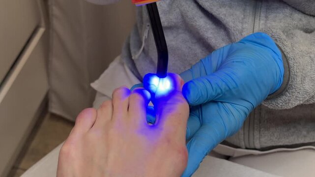 Close up footage of professional podiatrist using blue UV curing light during toenail treatment procedure. Foot care, podology, hygiene, healthcare and beauty salon concept with medical gloves and ped