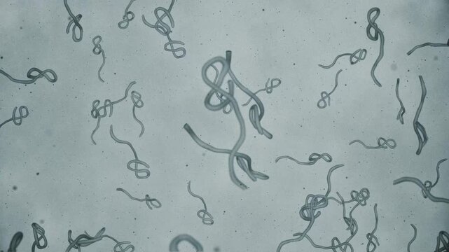 Microscopic view of infectious Ebola Virus cells or virions. Full HD and looping medical and healthcare concept animation.