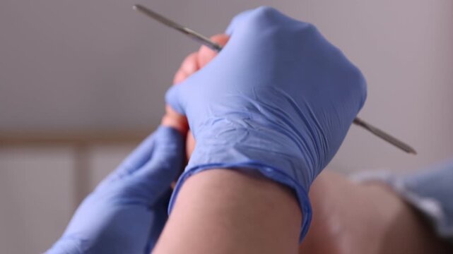 Podiatrist with chisel tool examining client's fingers on foot indoors, closeup