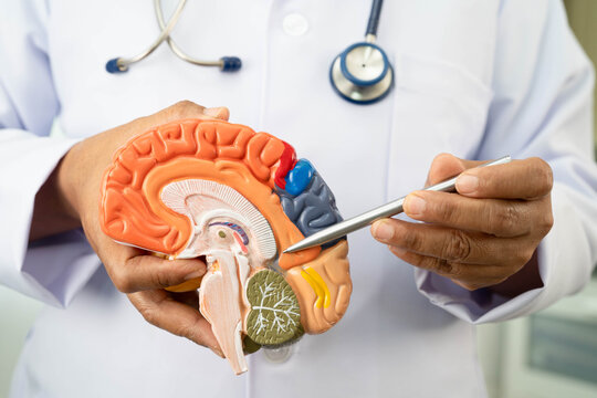 Alzheimer disease, Asian doctor holding brain anatomy model for study diagnosis and treatment in hospital.