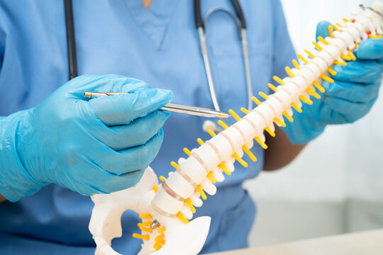 Asian doctor holding spinal nerve and bone model, Lumbar spine displaced herniated disc fragment for treatment medical in the orthopedic department.