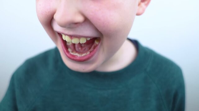 10 year old boy at pediatric dentist showing milk tooth extraction. Concept of caries treatment, physiological change of teeth and permanent teeth eruption in school age children.