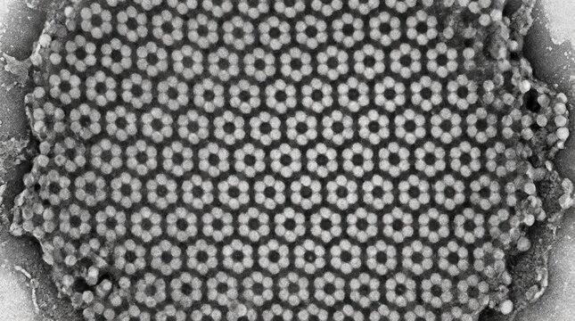 Negative stain TEM of archaeal S layer glycoprotein paracrystalline array