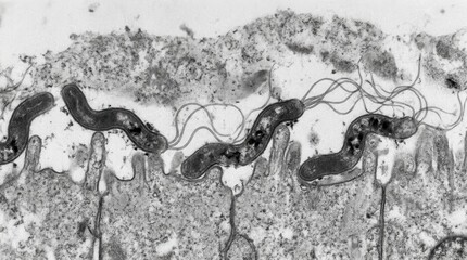 Obraz premium Helicobacter pylori Urease Activity, Stomach Mucosa Biopsy TEM
