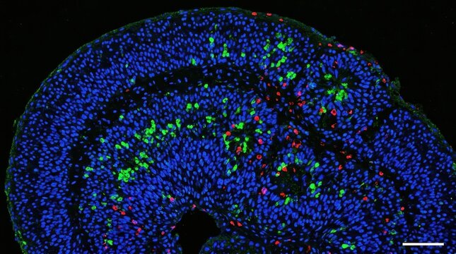 Zika Virus Neuroprogenitor Apoptosis, Confocal Brain Organoid