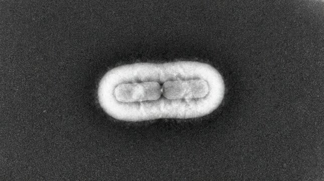 Haemophilus influenzae Type b Capsule TEM Bacterial Pair