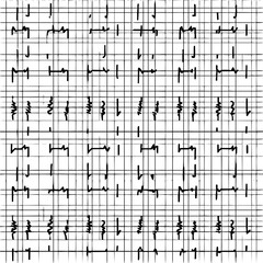Fototapeta premium ECG Graph on Grid Paper