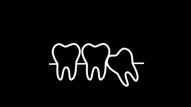 2D outline animation of an impacted wisdom tooth with an alert exclamation mark on black background