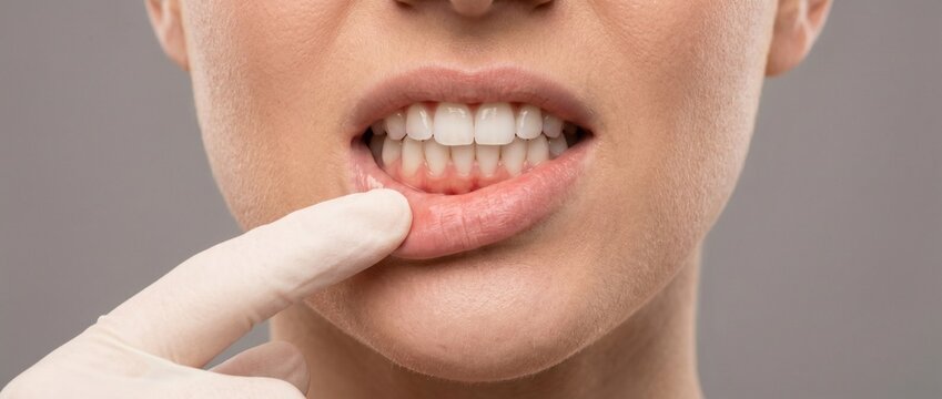 Close-up of dentist hand in medical glove pulling down patient's lower lip to examine teeth and gums. Dental health, gingivitis, and oral hygiene concept
