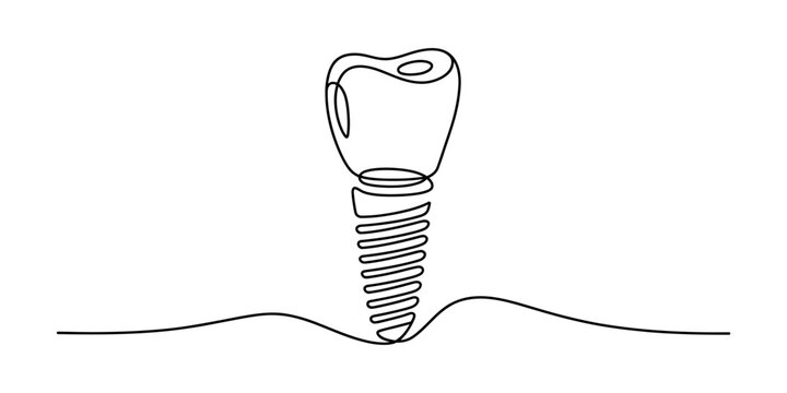 Drawing of screw in ground