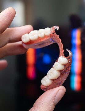 3D Printed Flexible Partial Denture Similar to Valplast with Aesthetic Clasps and Digital Fabrication