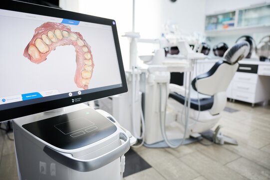 Digital dental scanner shows 3D teeth model in modern clinic