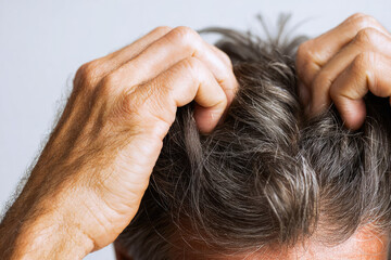 Naklejka premium Male with gray hair using both hands to scratch scalp, close-up view highlighting fingers and hair texture against a neutral background