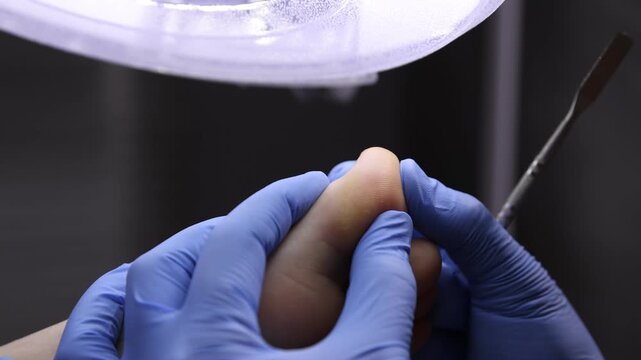 Podiatrist with chisel tool examining client's fingers on foot indoors, closeup