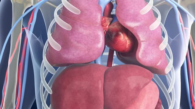 Thrombus blocks heart vessels, causing myocardial infarction. This triggers multiple organ failure due to reduced systemic perfusion. 3D animation of cardiogenic shock complications.