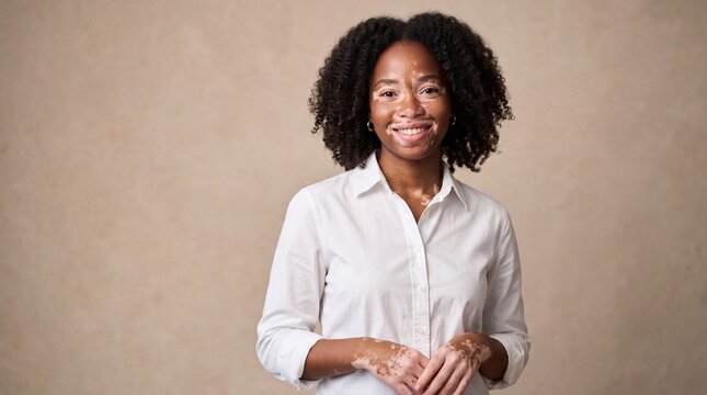 Portrait of beautiful woman with vitiligo smiling while wearing white classic button up cotton shirt.
