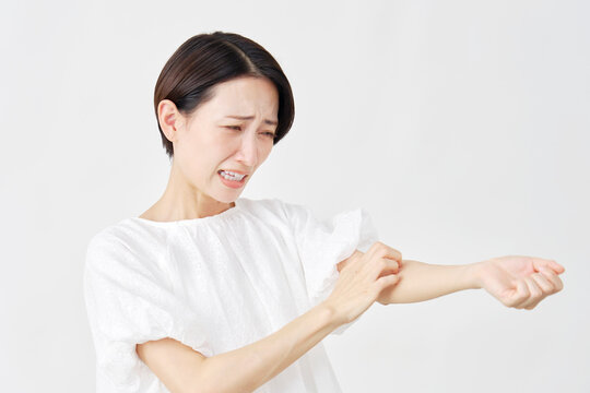 ミドルエイジ女性　蕁麻疹　白背景