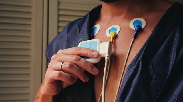 Electrodes of Holter monitor on the body, a portable device that continuously records the heart's electrical activity, electrocardiogram, for 24 hours. High quality 4k footage