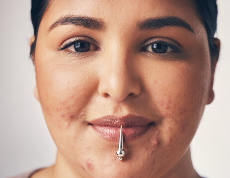 Closeup portrait of a smiling woman with acne blemishes on her cheeks and a vertical labret spike lip piercing