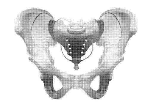 Cybernetic Orthopedic Pelvis Prosthetic 3D Illustration with Titanium Ilium and Ceramic Hip Socket