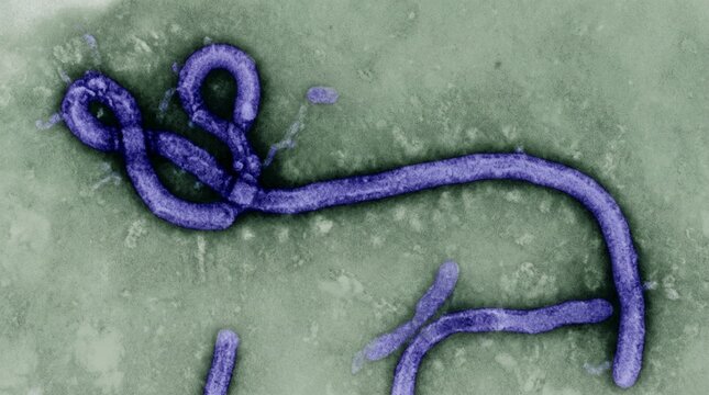 Transmission electron micrograph of ebola virus particles