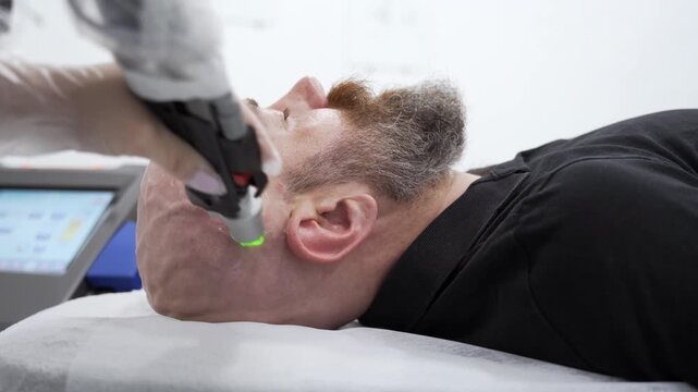 Close-up shot of Bold man head depilation laser hair in ears removal procedure treatment with alexandrite laser, unpainful procedure.