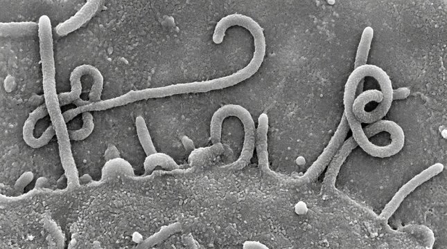 Scanning electron micrograph of ebola virus particles
