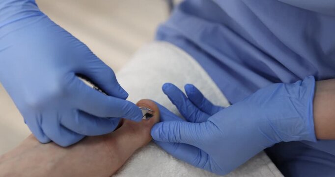 Podiatrist trimming patient's toenails with nail nippers in clinic, closeup. Camera moving in