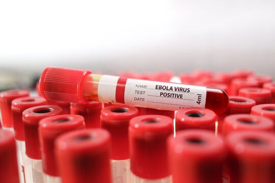 Ebola Virus Positive Blood Sample, A blood collection tube labeled Ebola Virus Positive rests on top of a laboratory rack, representing disease diagnosis and clinical analysis