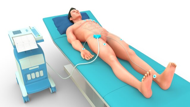 An electrocardiogram (ECG or EKG) is a quick, safe, and noninvasive test that records the electrical signals of your heart to check for heart rhythm issues, structural damage, or signs of a heart atta