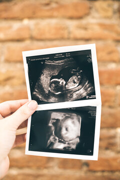 Woman hands holding two baby girl ultrasounds, 4D ultrasound
