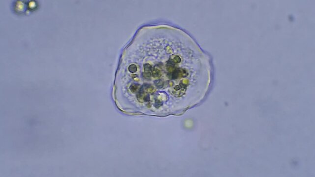 Micro organism - amoeba, time lapse