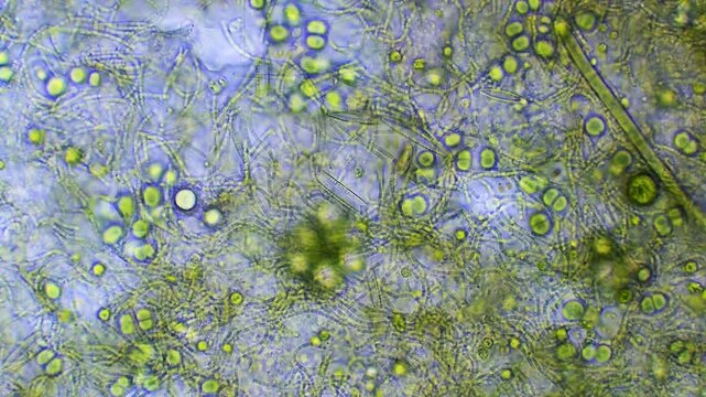 Micro organism - algae and bacterum