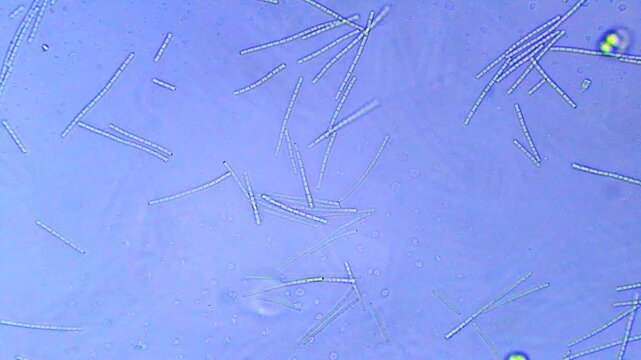 Micro organisms - algae cells moving
